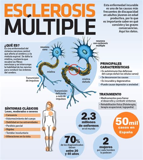 esclerose multipla resumo|esclerosis múltiple en niños.